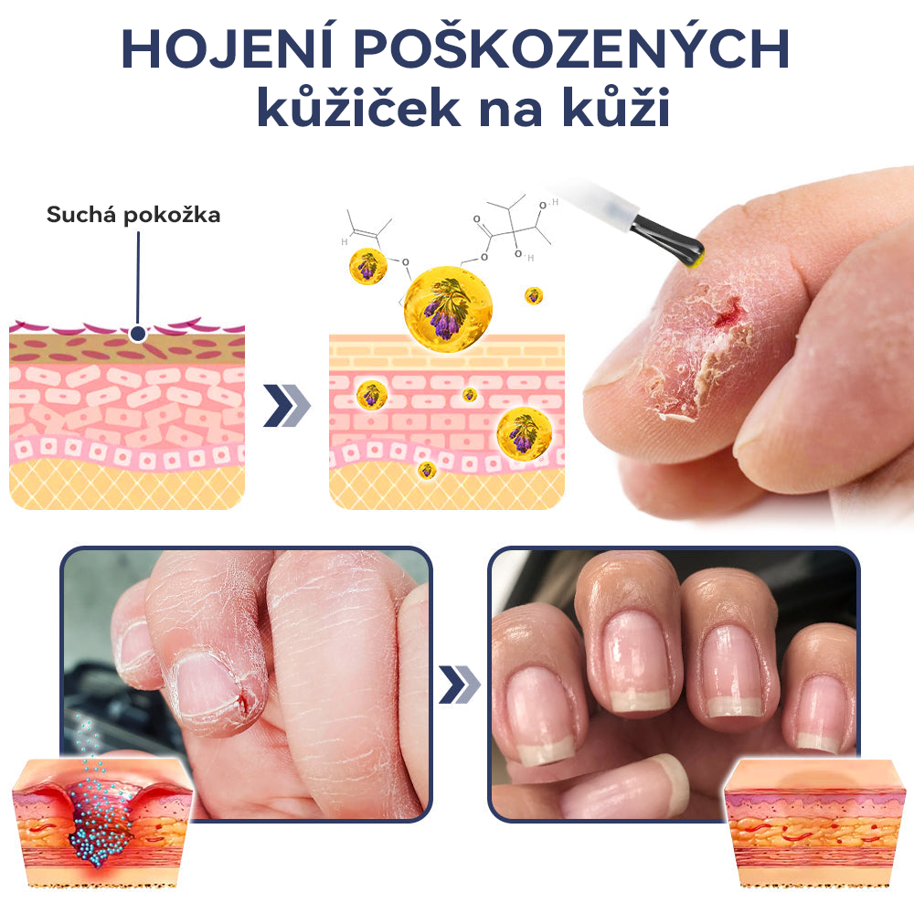 🍐𝐕𝐬𝐨𝐱𝐚™ 𝐋éč𝐛𝐚 𝐊𝐨𝐦𝐨𝐧í𝐜í 𝟕 𝐃𝐧í 𝐑ů𝐬𝐭 𝐚 𝐏𝐨𝐬í𝐥𝐞𝐧í 𝐒é𝐫𝐮𝐦 𝐍𝐚 𝐍𝐞𝐡𝐭𝐲