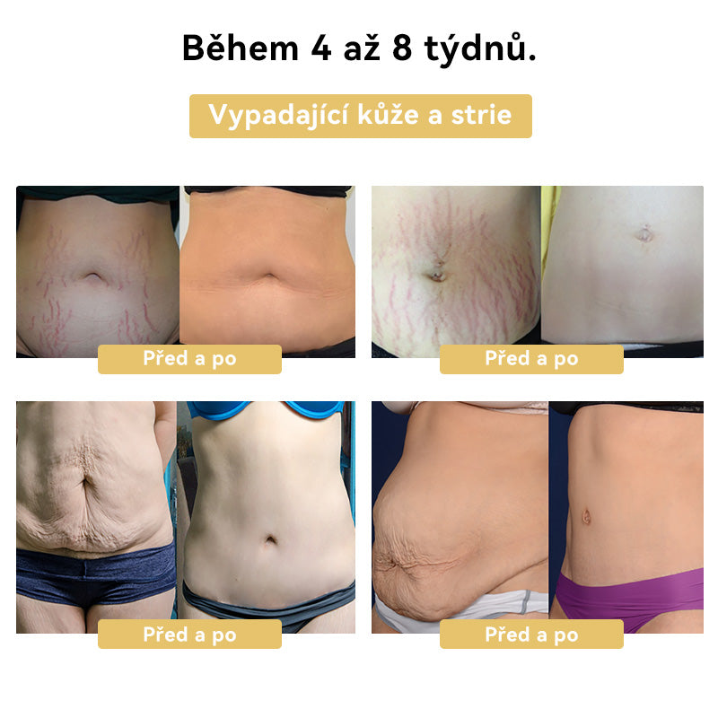 🎯𝐅𝐑𝐎𝐏𝐔𝐍™ 𝐕č𝐞𝐥í𝐦 𝐣𝐞𝐝𝐞𝐦 𝐙𝐞š𝐭í𝐡𝐥𝐮𝐣í𝐜í 𝐤𝐫é𝐦🐝 (𝑽𝒉𝒐𝒅𝒏ý 𝒑𝒓𝒐 𝒗š𝒆𝒄𝒉𝒏𝒚 𝒑𝒓𝒐𝒃𝒍é𝒎𝒚 𝒔 𝒍𝒚𝒎𝒇𝒂𝒕𝒊𝒄𝒌ý𝒎 𝒔𝒚𝒔𝒕é𝒎𝒆𝒎 𝒂 𝒐𝒃𝒆𝒛𝒊𝒕𝒖)