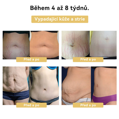 🎯𝐅𝐑𝐎𝐏𝐔𝐍™ 𝐕č𝐞𝐥í𝐦 𝐣𝐞𝐝𝐞𝐦 𝐙𝐞š𝐭í𝐡𝐥𝐮𝐣í𝐜í 𝐤𝐫é𝐦🐝 (𝑽𝒉𝒐𝒅𝒏ý 𝒑𝒓𝒐 𝒗š𝒆𝒄𝒉𝒏𝒚 𝒑𝒓𝒐𝒃𝒍é𝒎𝒚 𝒔 𝒍𝒚𝒎𝒇𝒂𝒕𝒊𝒄𝒌ý𝒎 𝒔𝒚𝒔𝒕é𝒎𝒆𝒎 𝒂 𝒐𝒃𝒆𝒛𝒊𝒕𝒖)