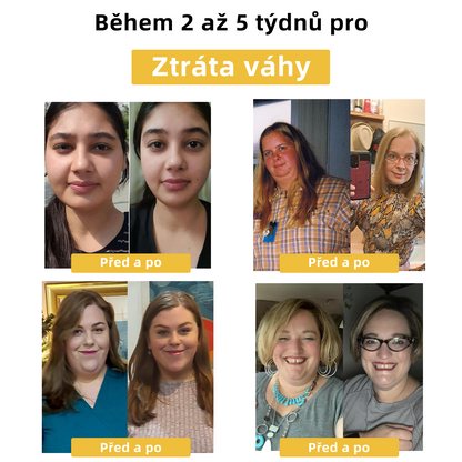 🎀🎀Cvreoz™ Včelí Jed Výstřihování Léčba Postižení🐝(pro všechny lymfatické problémy a obtíže)